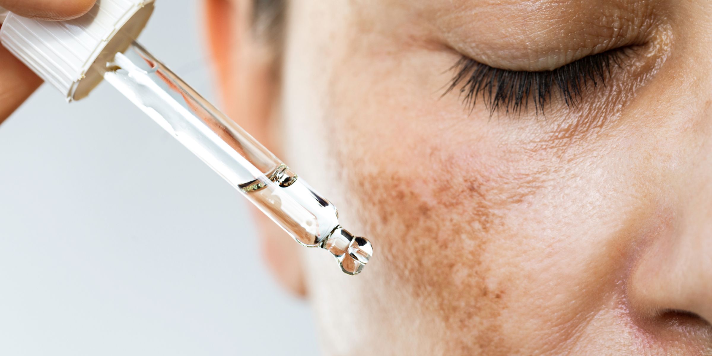 A woman applying serum to a dark patch of her skin | Source: Getty Images